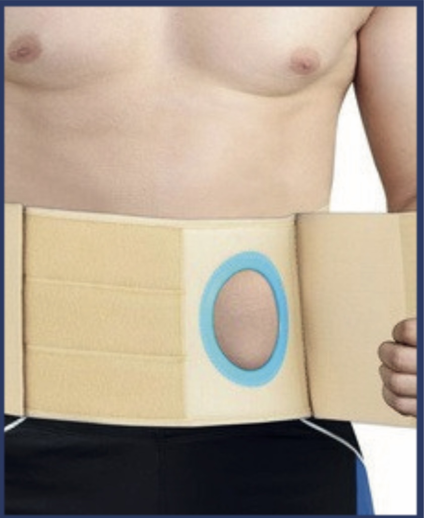 Colostomy Belt — Scanda Enterprises, medical supplies Moosapet Hyderabad